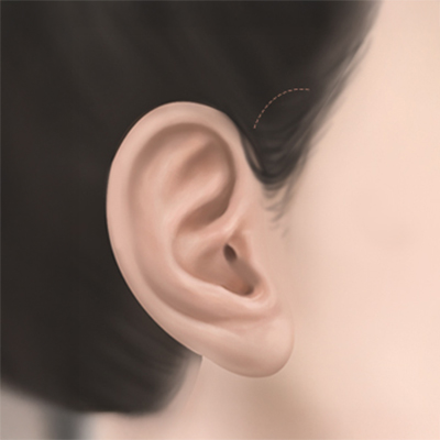Profile 1